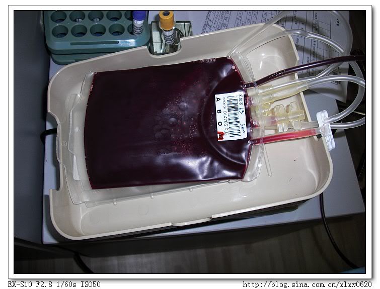 献血记(献血全程详细跟拍)